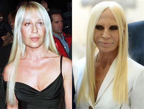 90s donatella versace|Donatella Versace before and after.